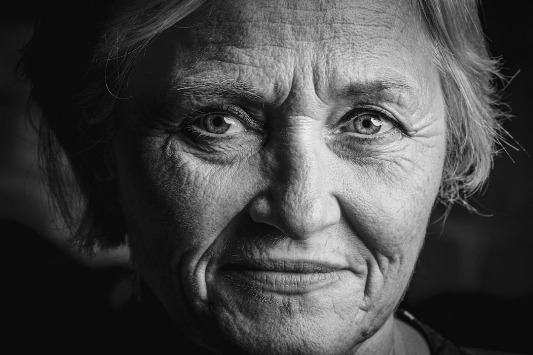 Kırışıklıklarla Savaşın: Boyun Germe Operasyonları ile Gençlik Işıltısını Yakalayın
