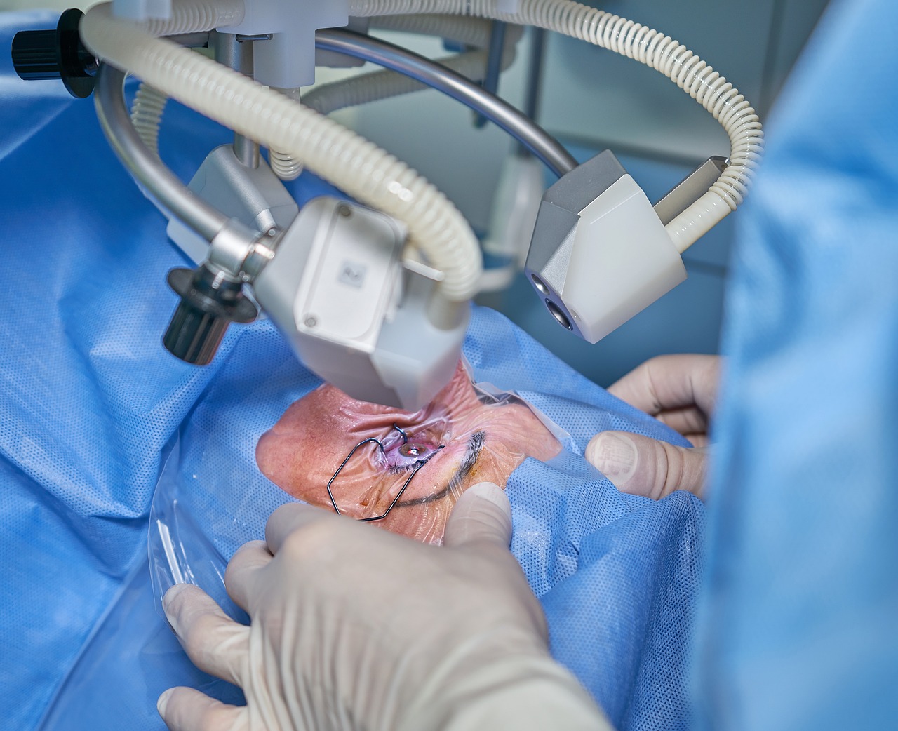 Liposuction ve Yanak Çene Estetiği