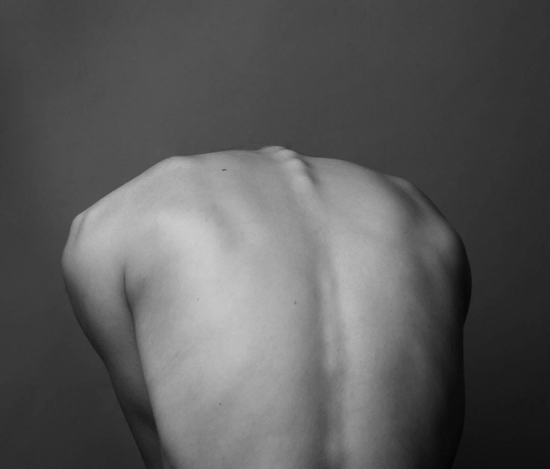 Liposuction ile Sırt Şekillendirme