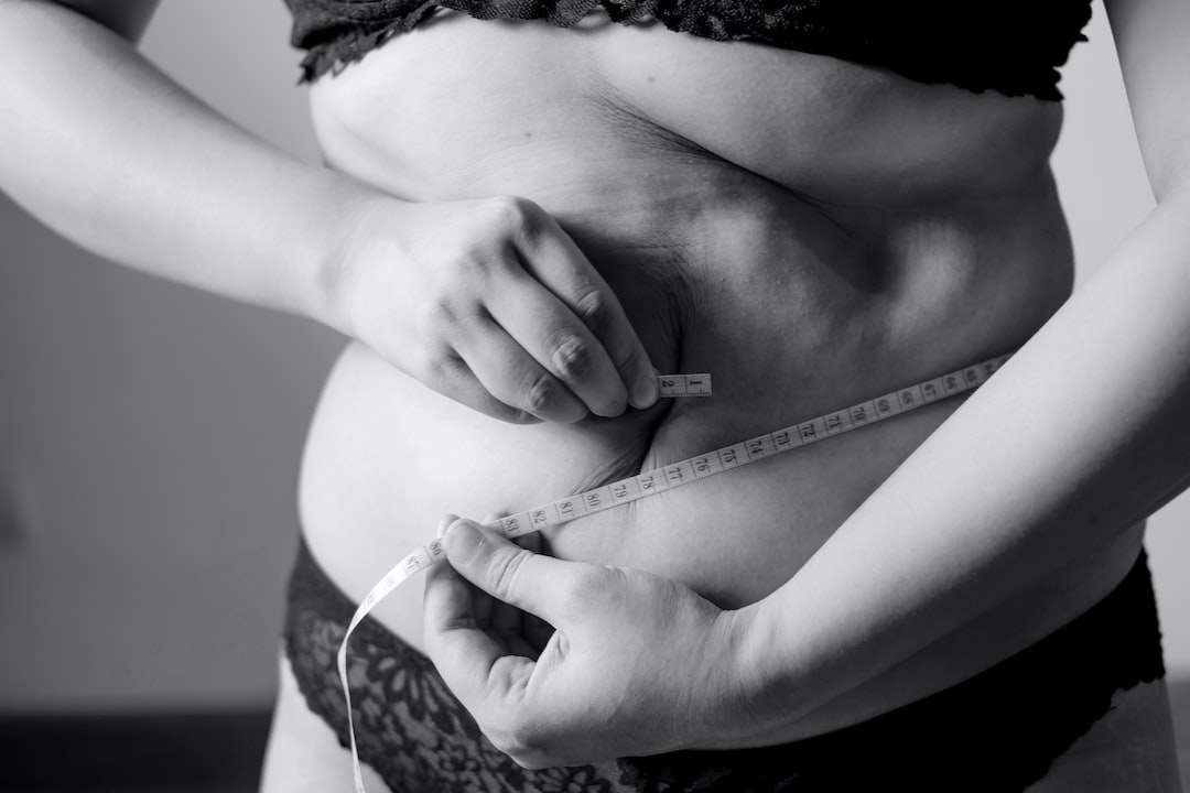 İzmir Estetik Cerrahi - Liposuction Nedir? Yağ Alma İşlemi Hakkında Temel Bilgiler