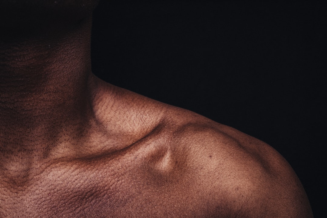 Boyun Germe Operasyonları (Neck Lift) Sonrası İyileşme Süreci Neler Beklemeli ve Nasıl Hazırlanmalı?
