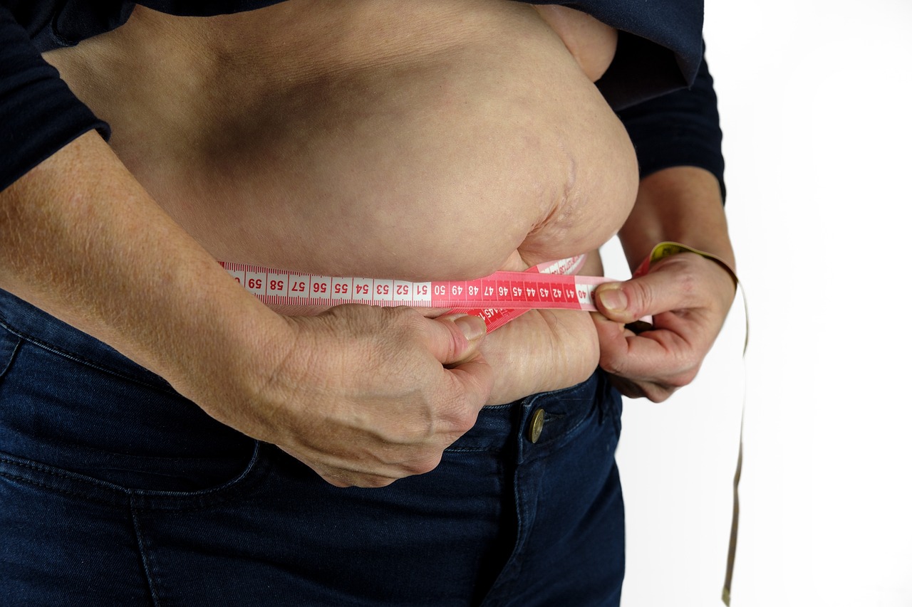 Sırt Liposuctionu ve Estetik Fazla Yağlardan Kurtulmanın Etkili Yolları